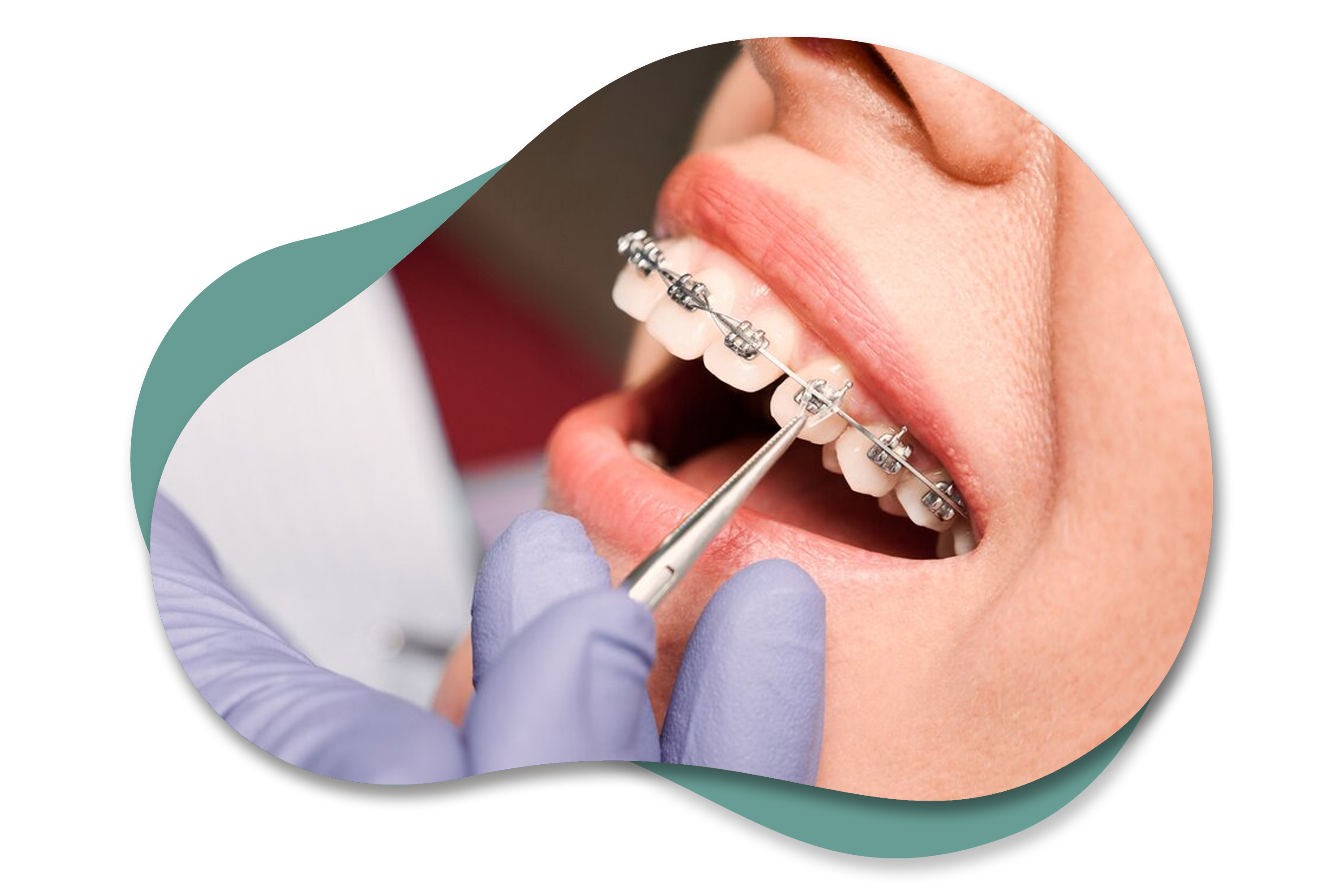 Ortodontik Tedaviler