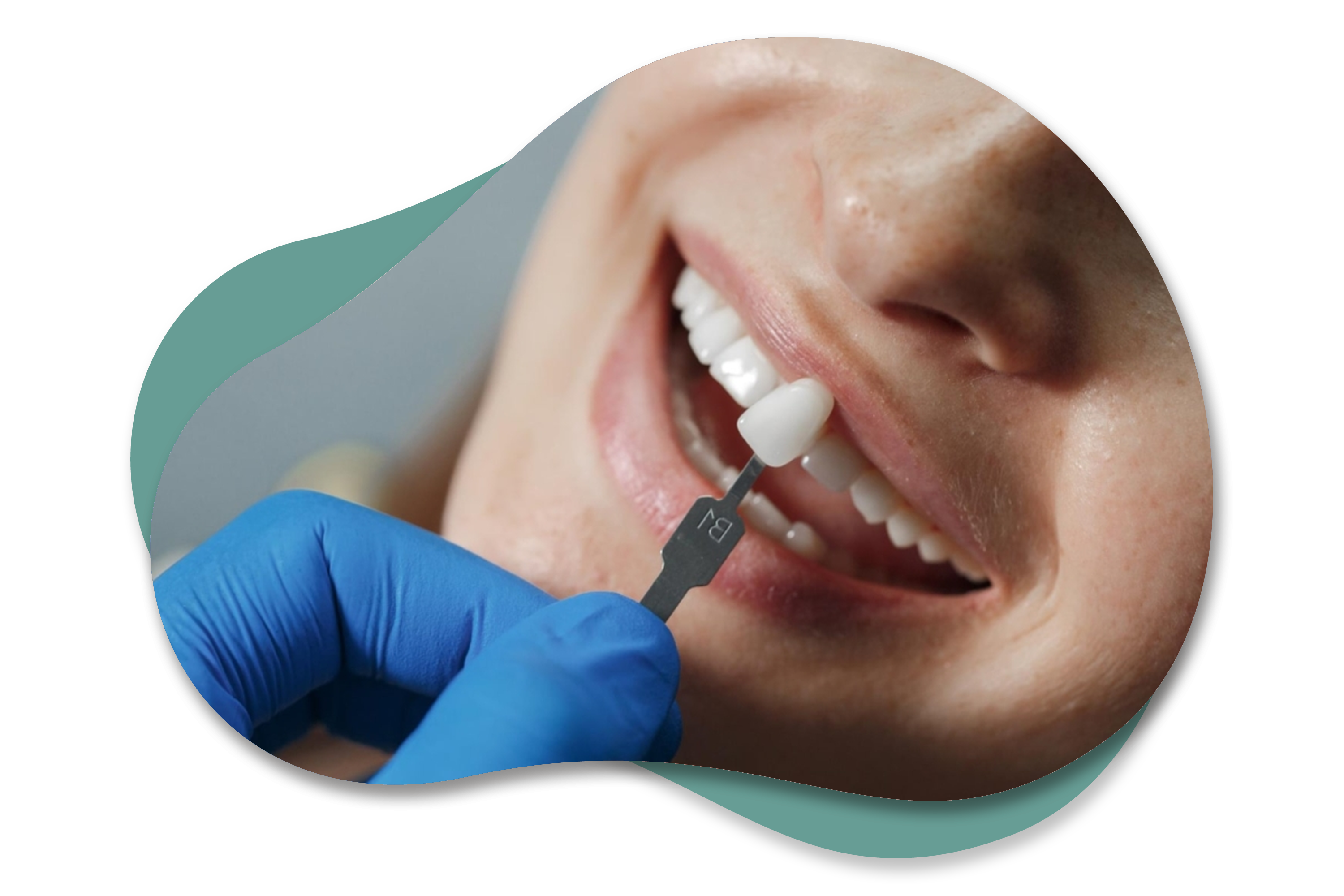 Restoratif Tedaviler